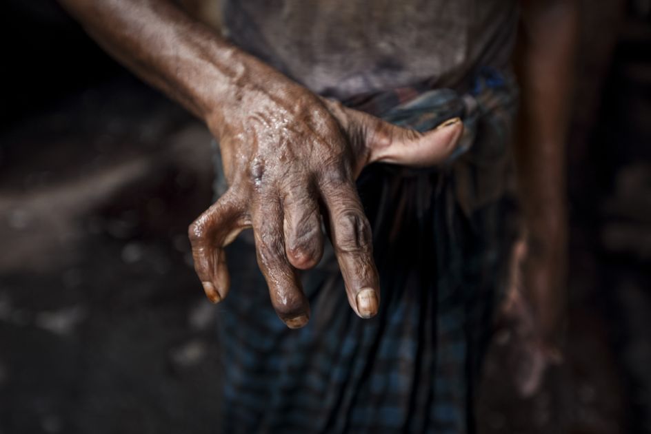 Eine Hand im Fokus, bei ein Finger gekrümt ist und ein Fingerist verkürzt